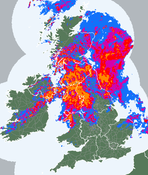 Radar