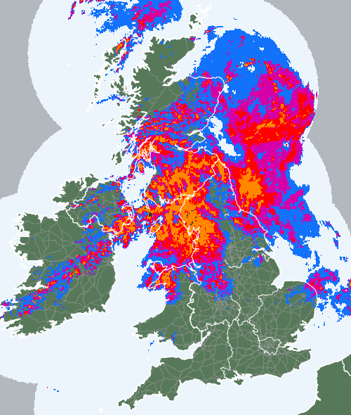 Radar