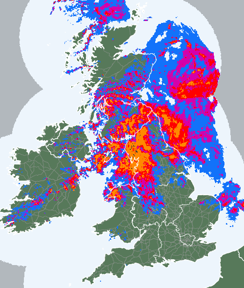 Radar