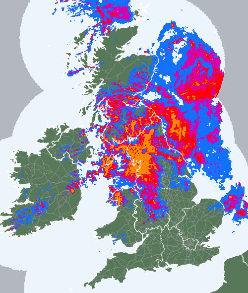 Radar