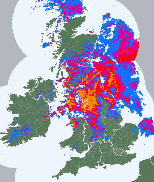 Radar