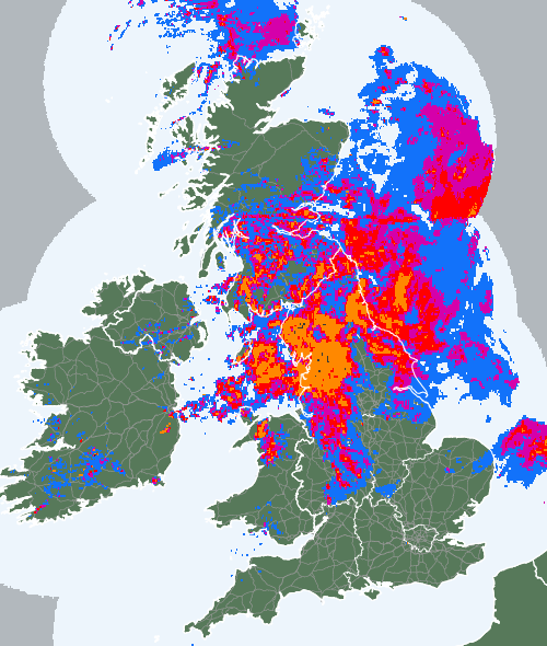 Radar