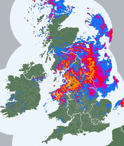 Radar