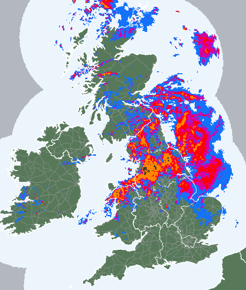 Radar