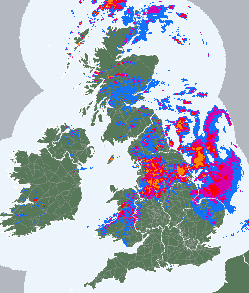 Radar