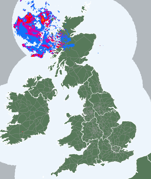 Radar