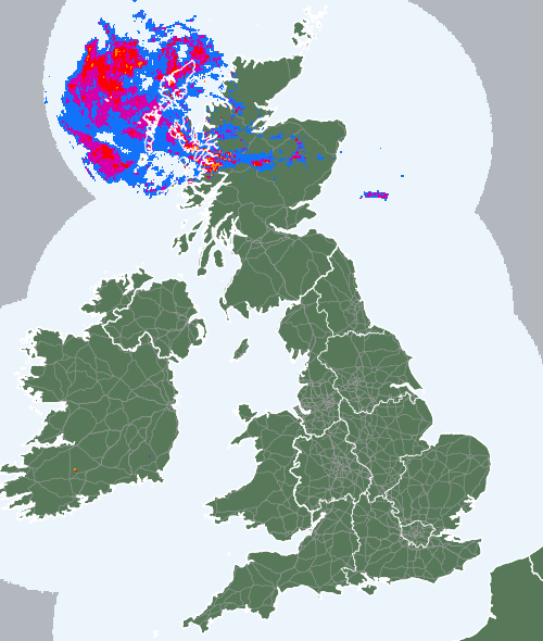 Radar