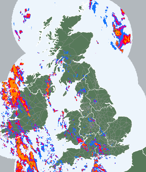 Radar