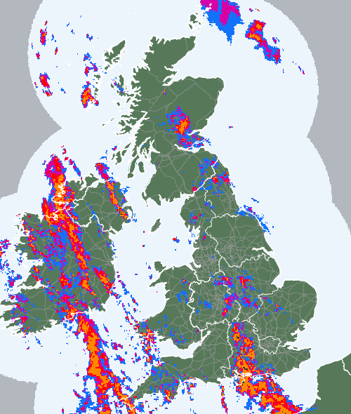 Radar
