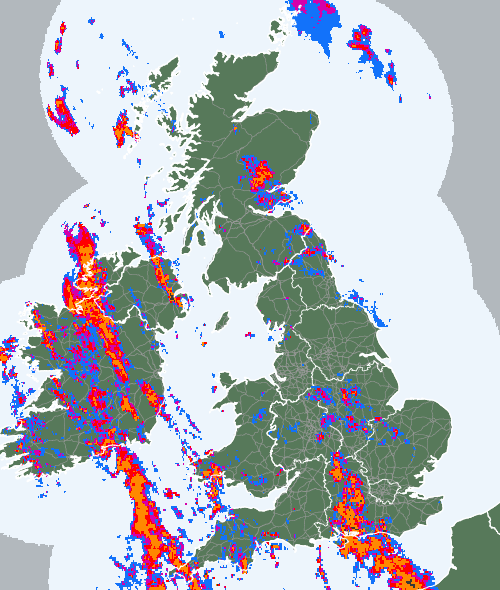 Radar