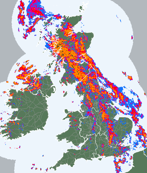 Radar