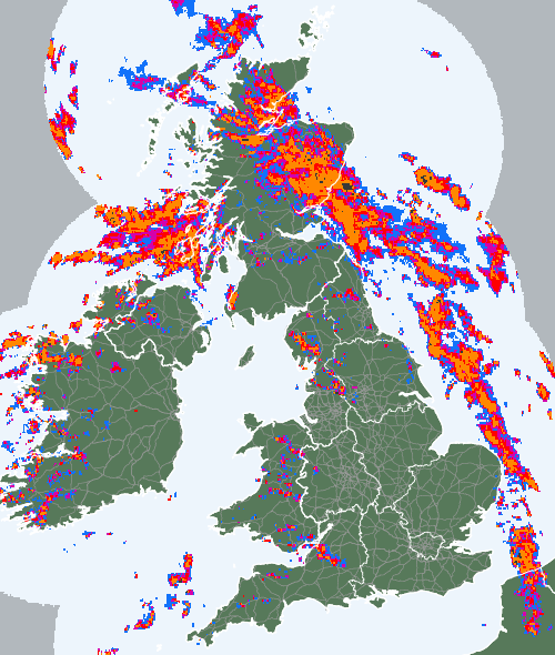 Radar