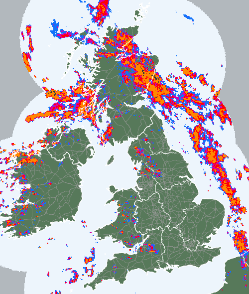 Radar
