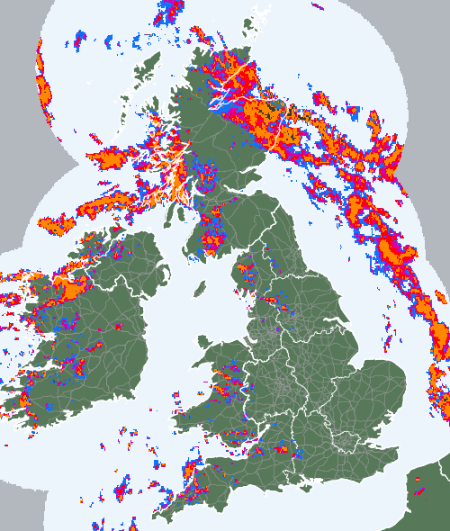 Radar