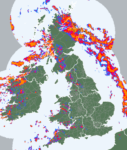 Radar