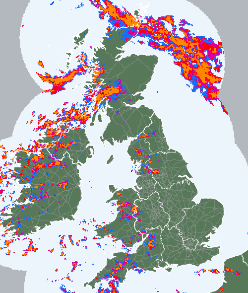 Radar