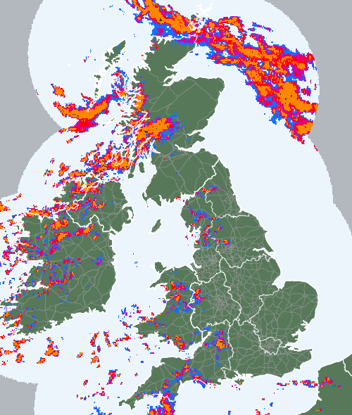 Radar