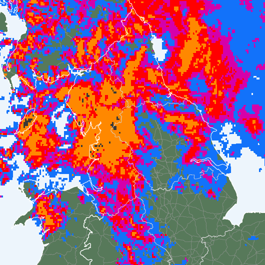 Radar