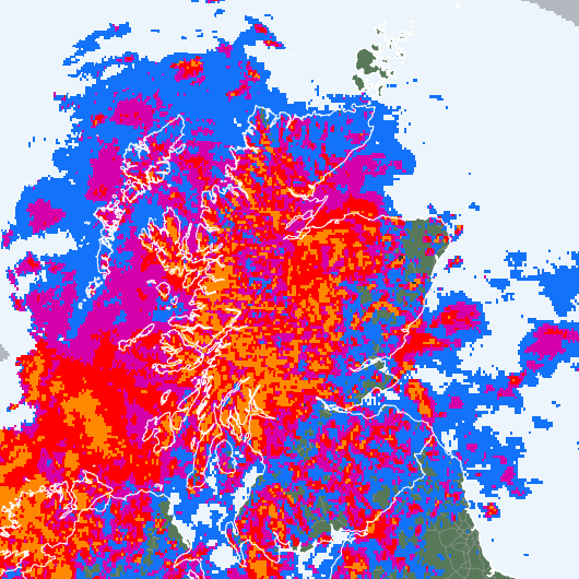 Radar
