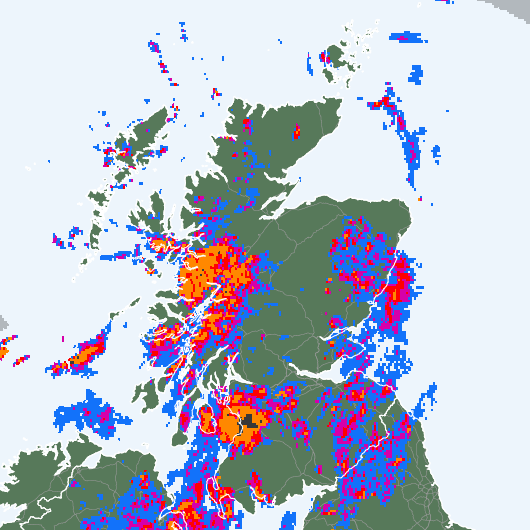 Radar