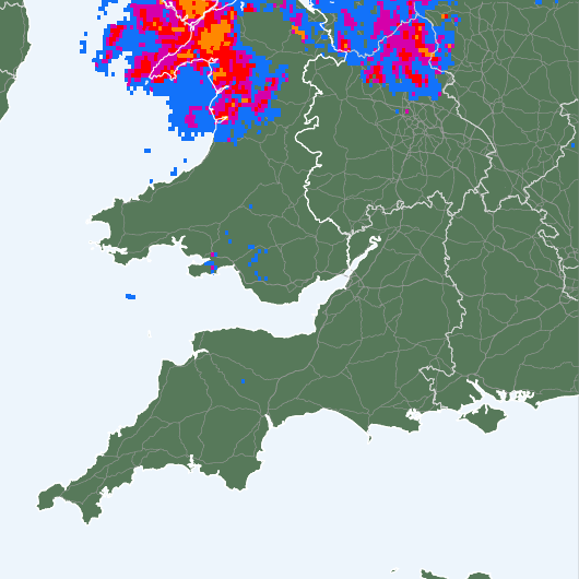 Radar
