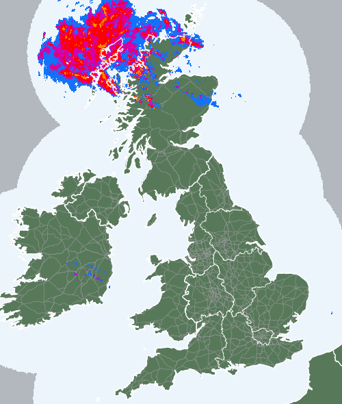 Radar