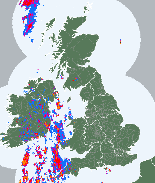 Radar