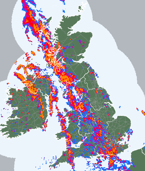 Radar