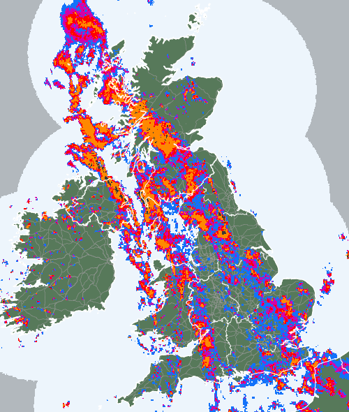 Radar