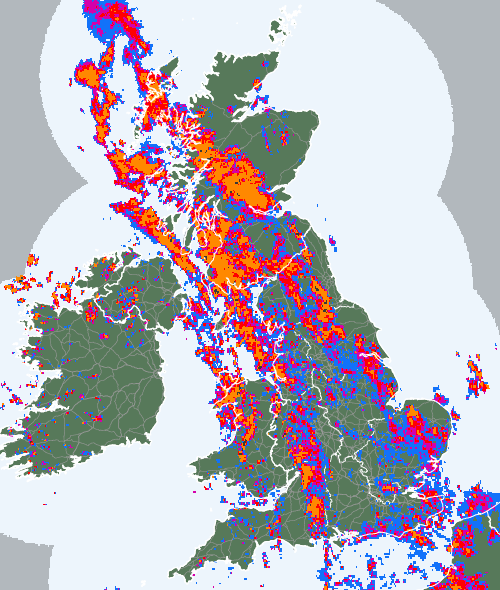 Radar