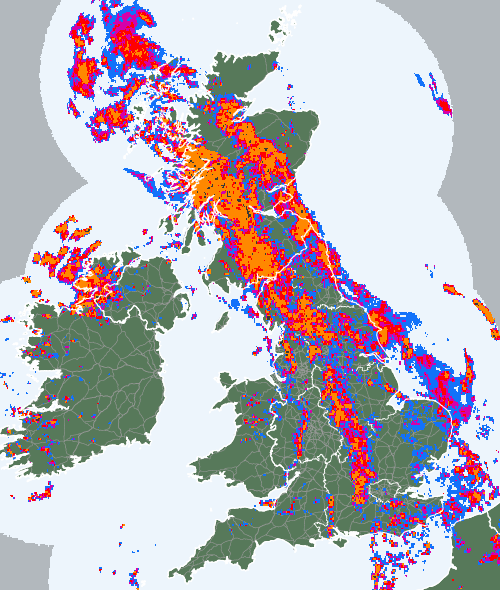 Radar