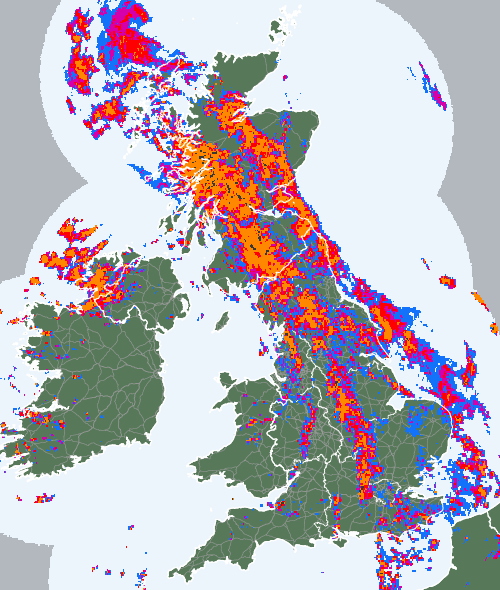 Radar