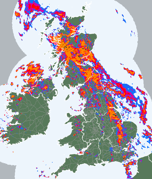 Radar
