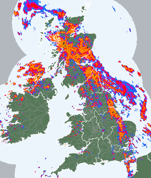 Radar