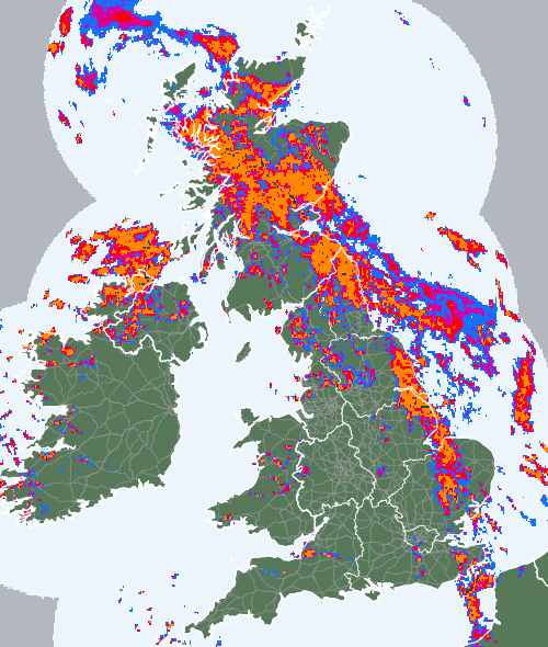 Radar