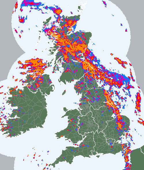 Radar