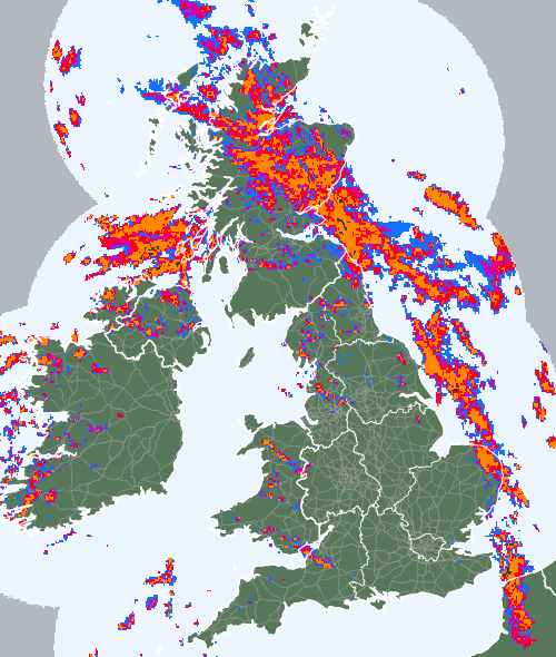 Radar