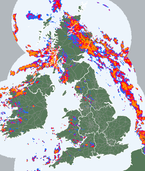 Radar