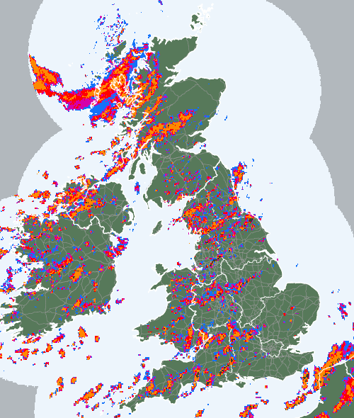 Radar