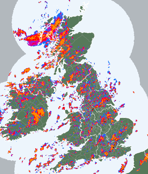 Radar