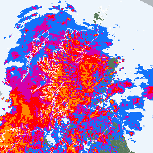 Radar