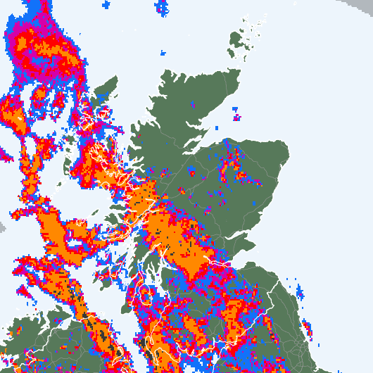Radar