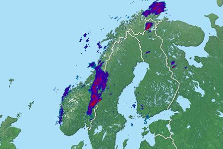 Radar