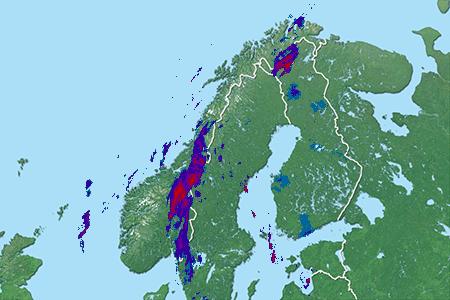 Radar