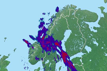 Radar
