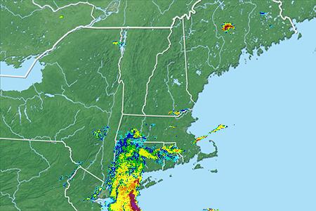 Radar