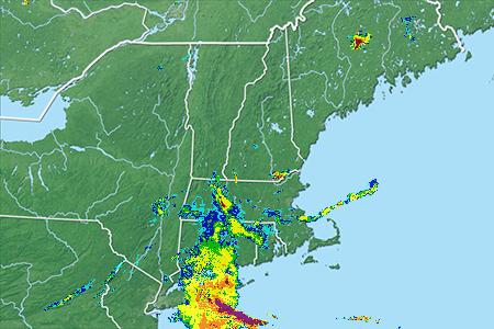Radar