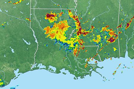 Radar