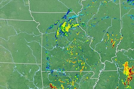 Radar