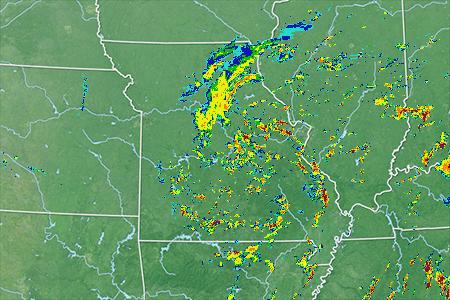 Radar